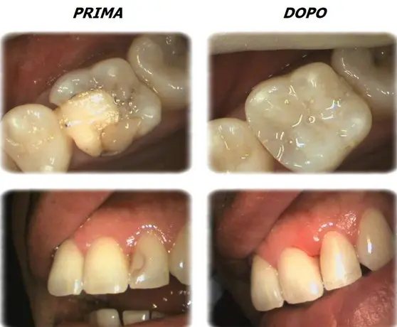 Otturazioni: immagine dal sito dell'ambulatorio