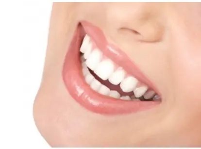 Sbiancamento dei denti